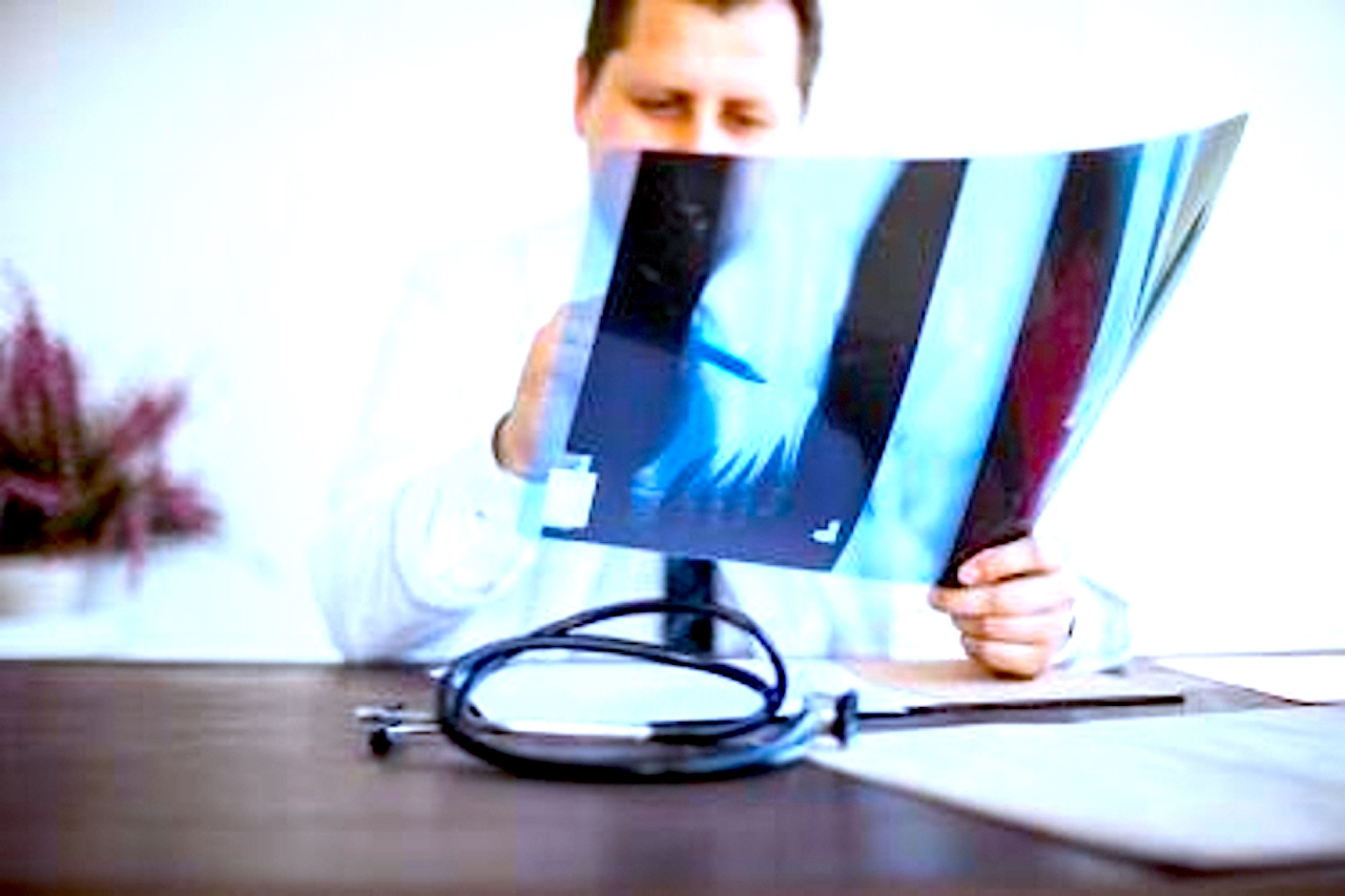 Rak nie czeka, liczy się czas