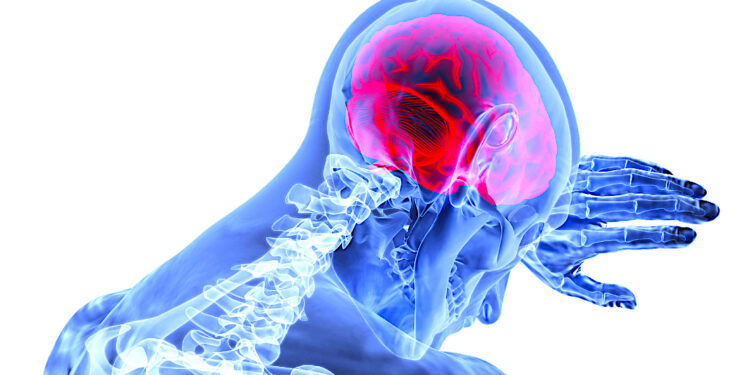 Pilotaż leczenia ostrej fazy udarów – we wrocławskim szpitalu im. Marciniaka