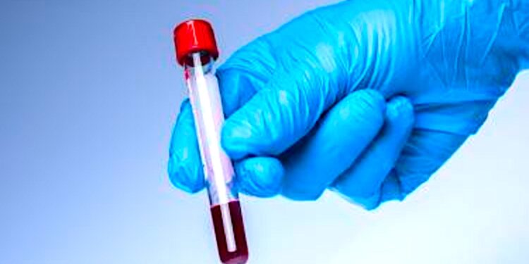 Przetaczanie seniorom krwi dzieci